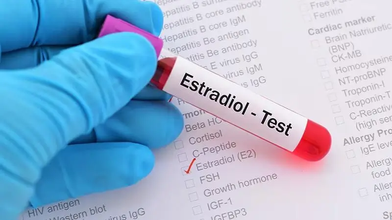 High Estradiol in Men: Causes, Symptoms & Treatment