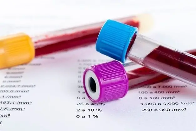 How to Read Your Hormone Bloodwork Results